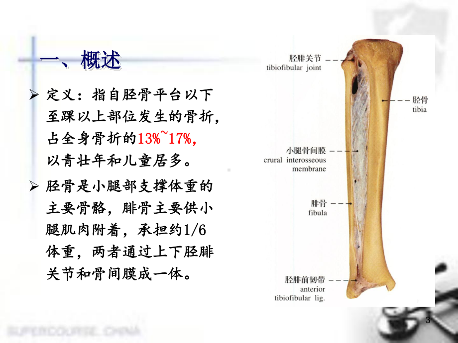 医学课件-胫腓骨骨折患者的个案护理课件.pptx_第3页