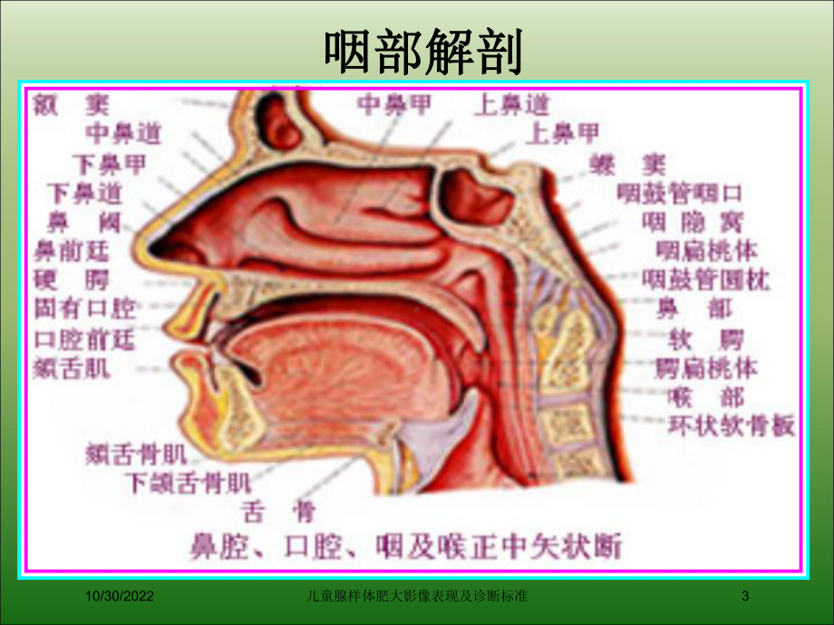 儿童腺样体肥大影像表现及诊断标准培训课件.ppt_第3页