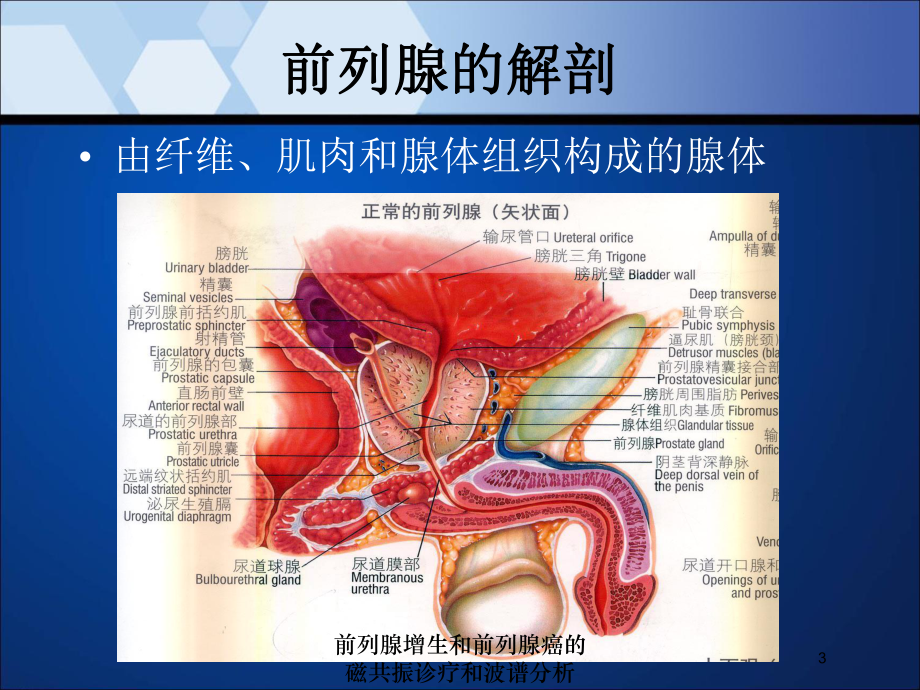 前列腺增生和前列腺癌的磁共振诊疗和波谱分析培训课件.ppt_第3页