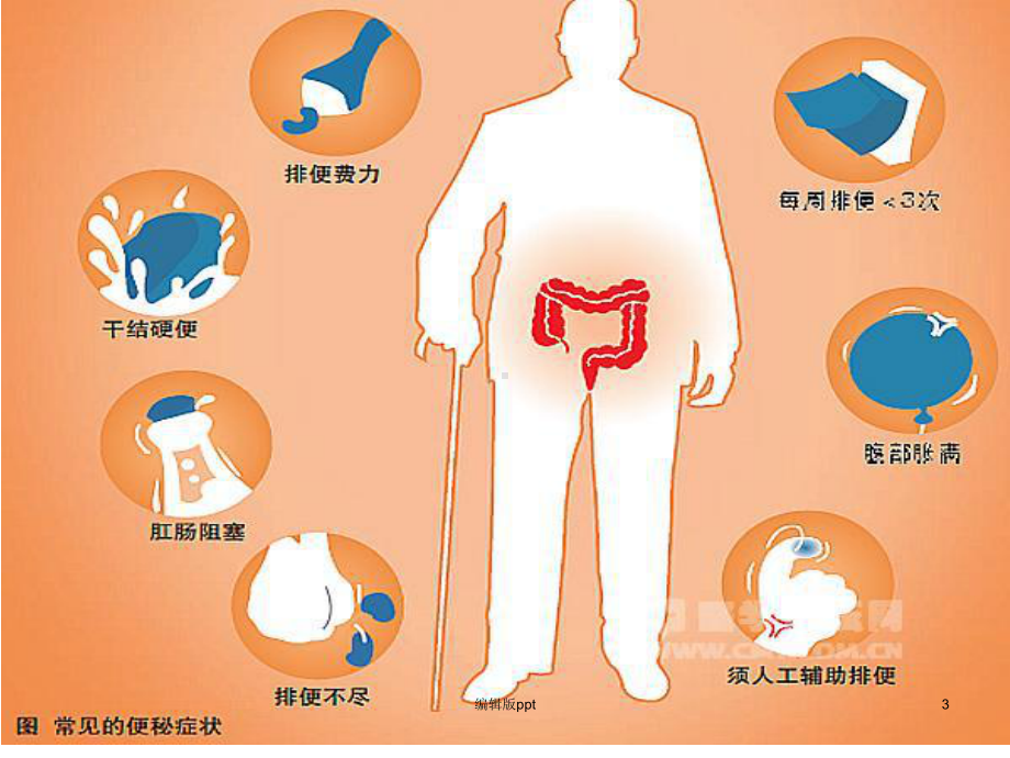 便秘健康教育医学课件.ppt_第3页