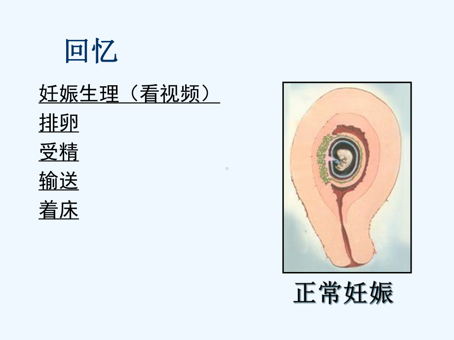 妊娠病异位妊娠课件.ppt_第3页