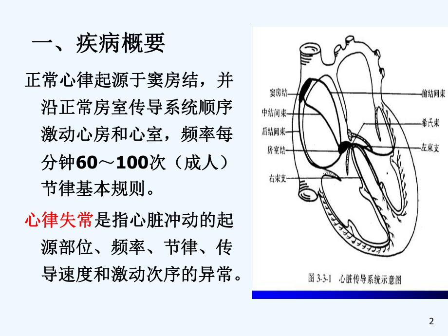 内科护理学心律失常课件.ppt_第2页