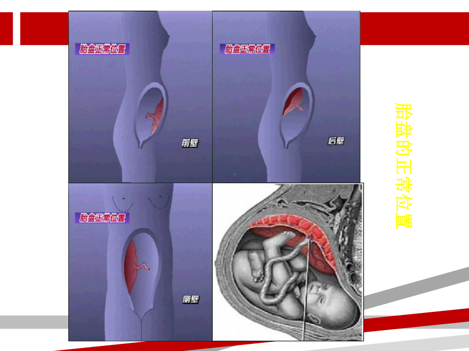 妇产科学课件前置胎盘.ppt_第2页