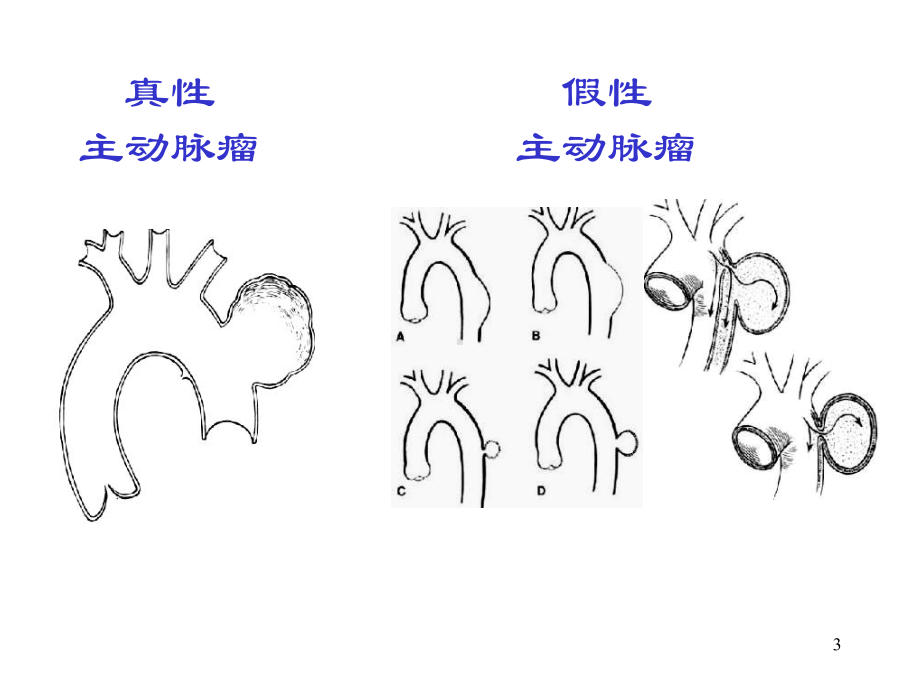 后得性心脏病的影像学诊断课件-2.ppt_第3页