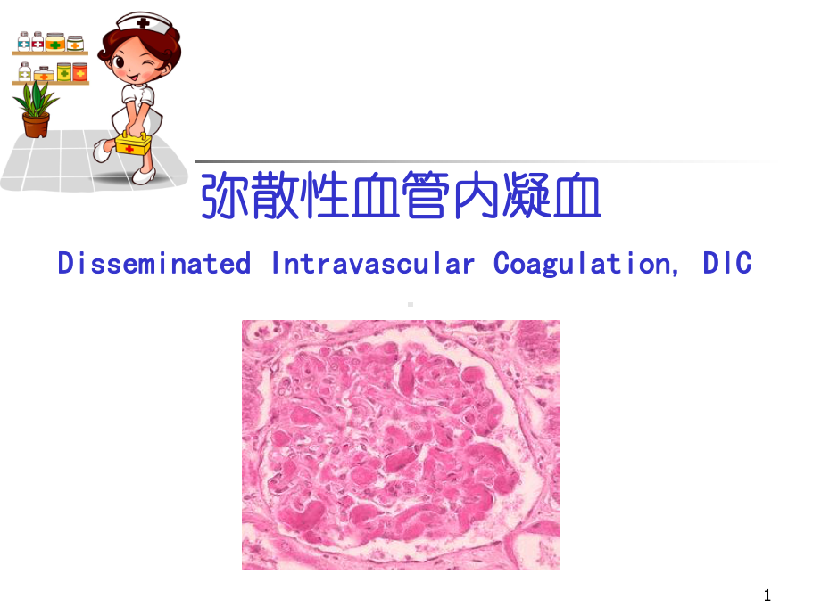 医学课件-DIC的诊断及治疗课件.ppt_第1页