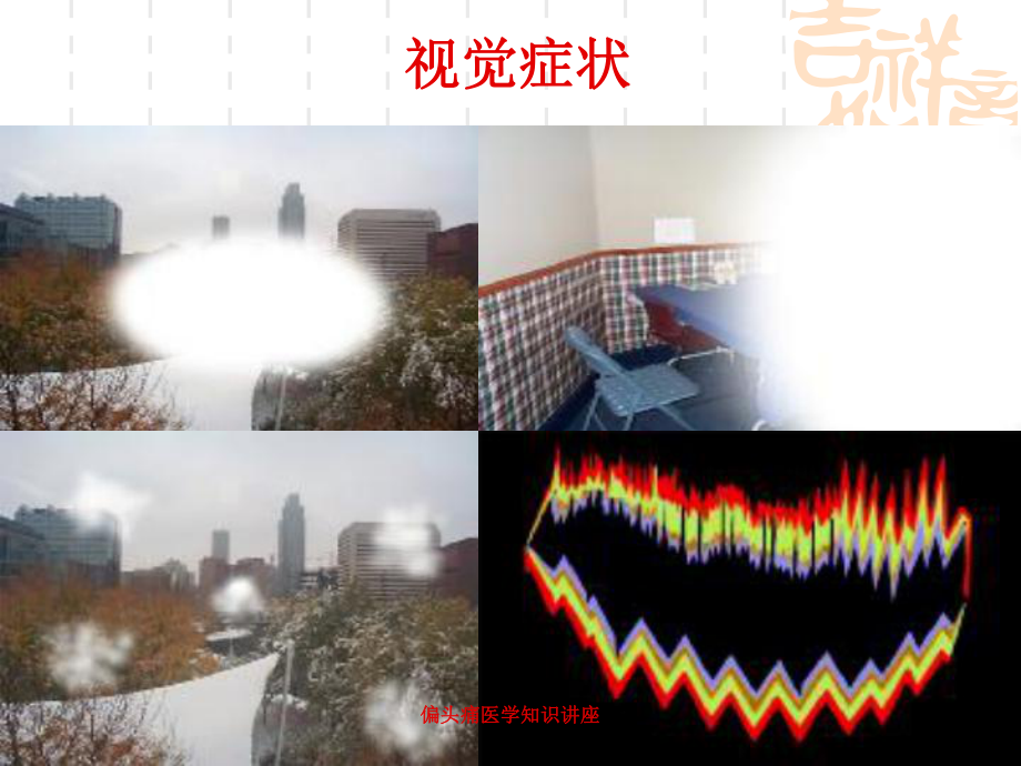 偏头痛医学知识讲座培训课件.ppt_第3页