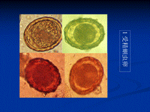 人体寄生虫学标本复习课件.pptx