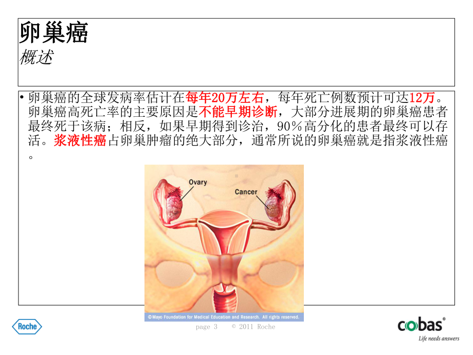 卵巢癌新型标志物HE4临床介绍课件.ppt_第3页