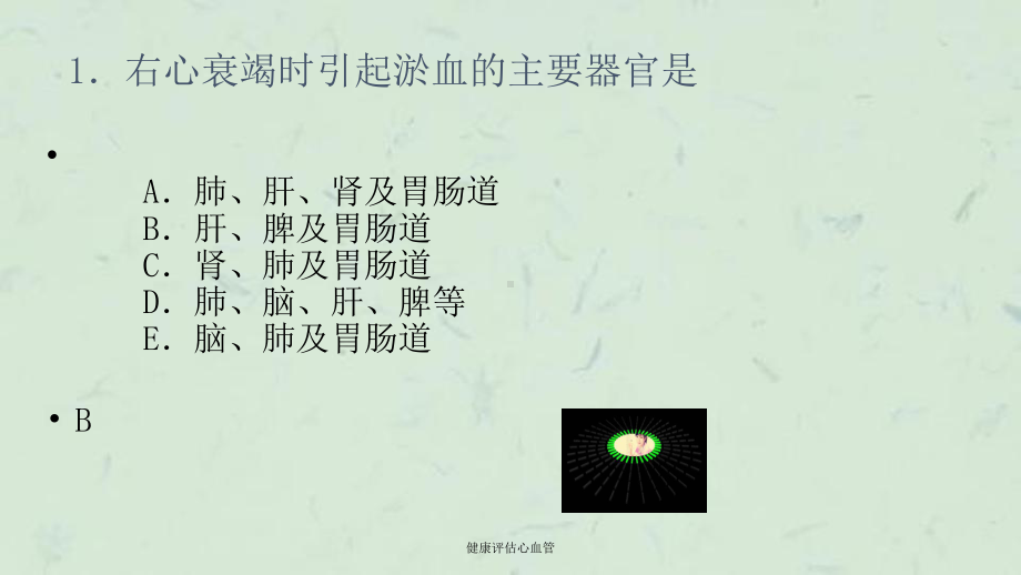 健康评估心血管课件.ppt_第2页