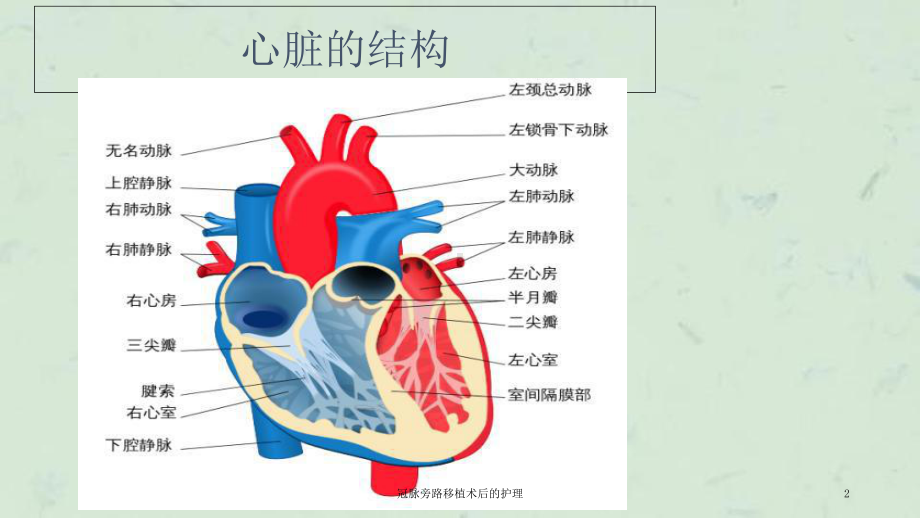 冠脉旁路移植术后的护理课件.ppt_第2页