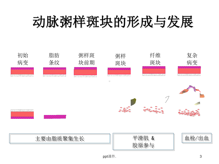 冠心病及心衰的药物治疗精选课件.ppt_第3页