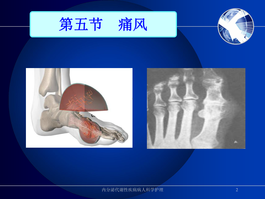 内分泌代谢性疾病病人科学护理培训课件.ppt_第2页