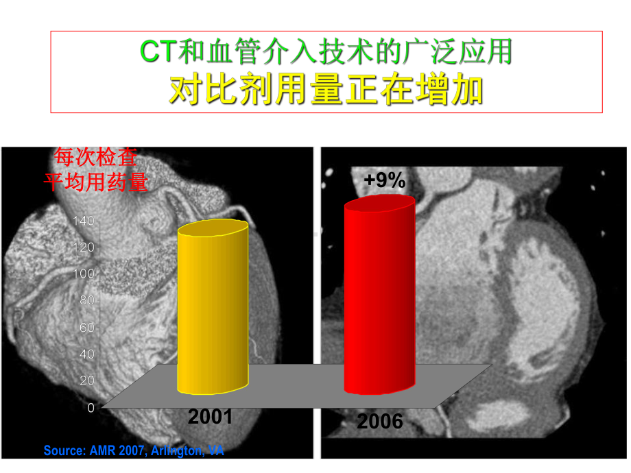 对比剂肾病研究医学课件.ppt_第3页