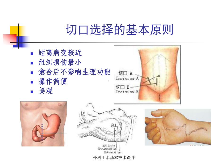 外科手术基本技术课件.ppt_第3页