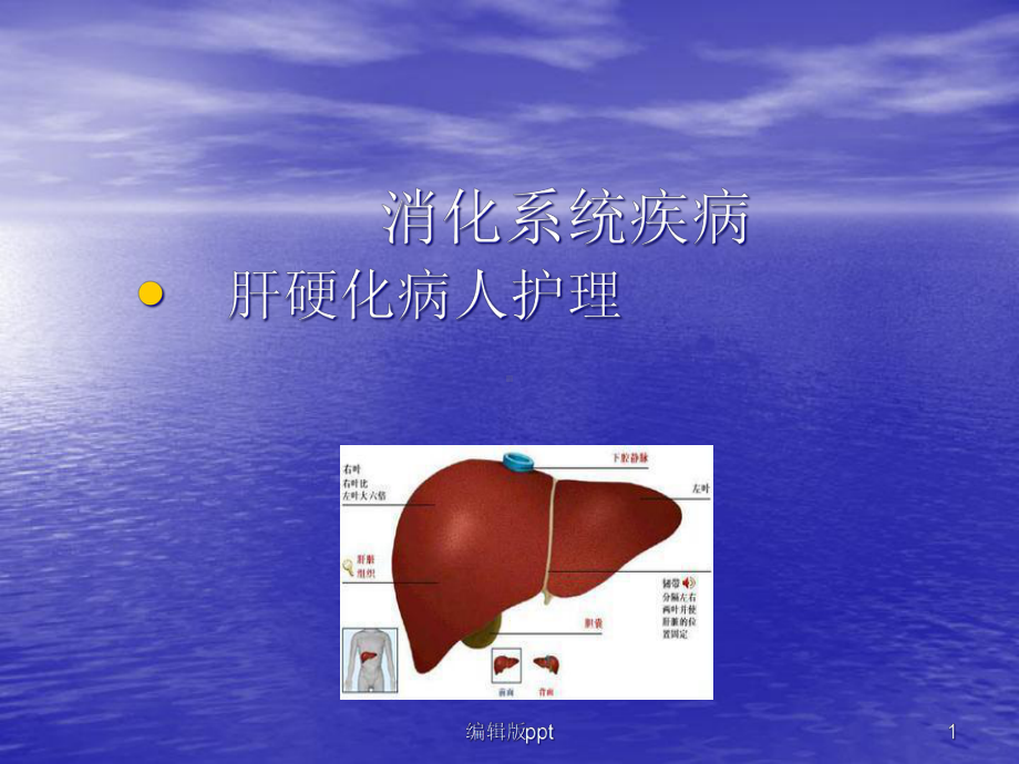 内科护理学肝硬化-课件.ppt_第1页