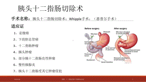 医学课件胰腺指肠手术麻醉ABC.ppt