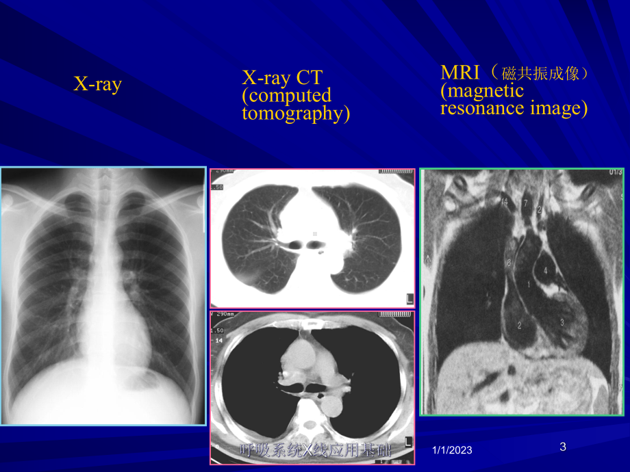 呼吸系统X线应用基础课件.ppt_第3页