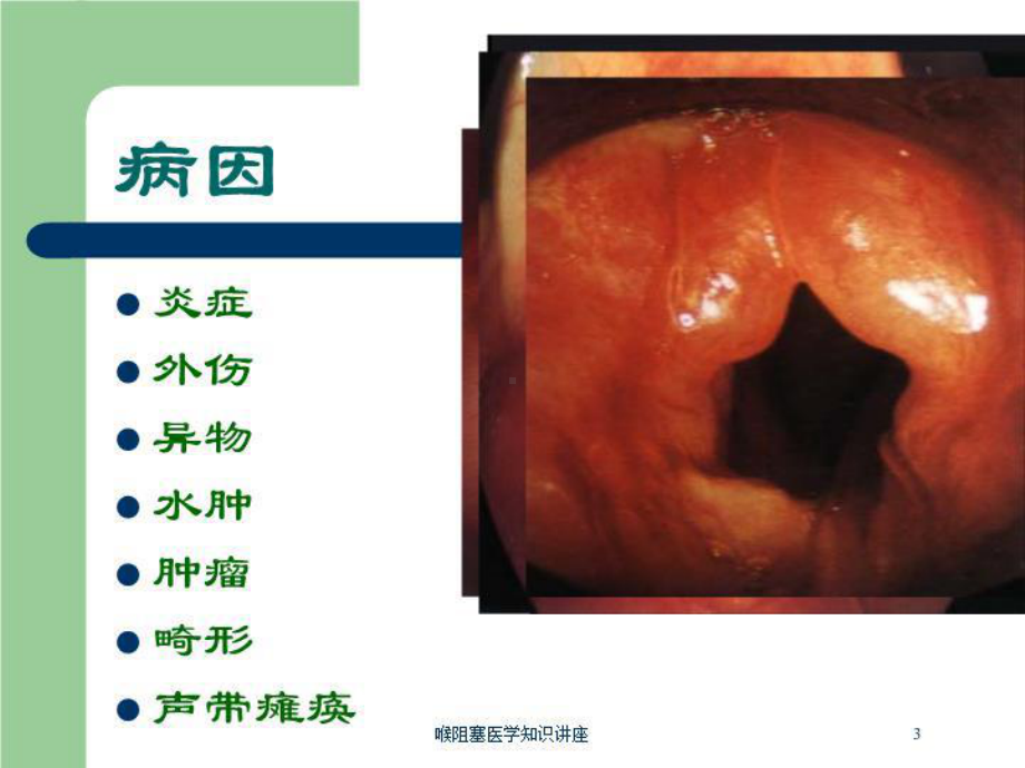 喉阻塞医学知识讲座培训课件.ppt_第3页