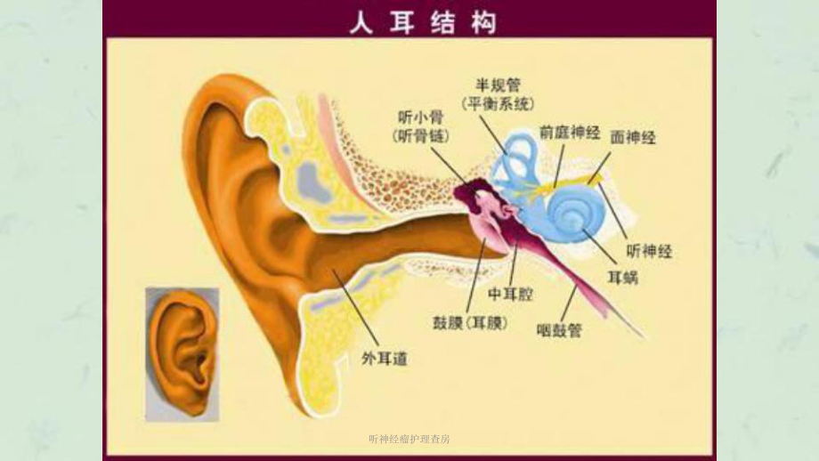 听神经瘤护理查房课件.ppt_第3页