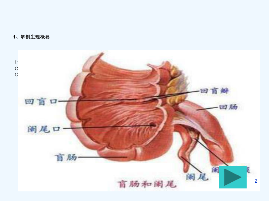 产褥期阑尾炎病人护理课件.ppt_第2页