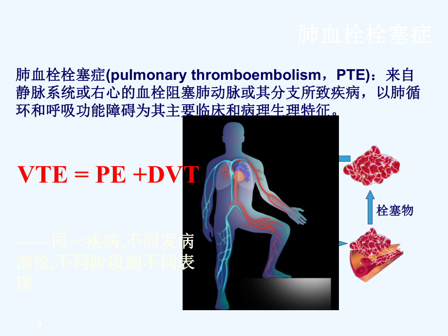 大面积肺栓塞与急性右心功能不全课件.ppt_第3页