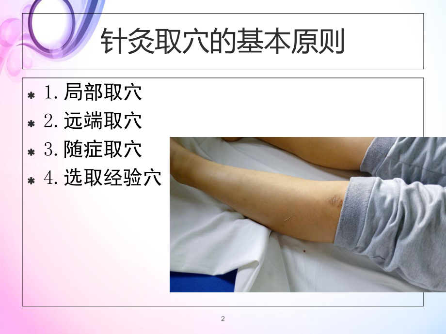 医学课件-针灸治疗的常见病课件.ppt_第2页