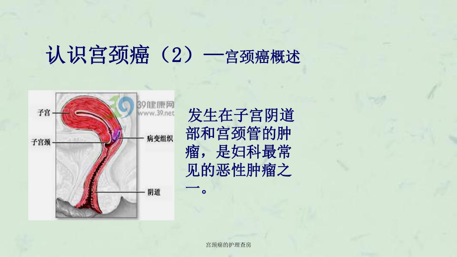 宫颈癌的护理查房课件.ppt_第3页