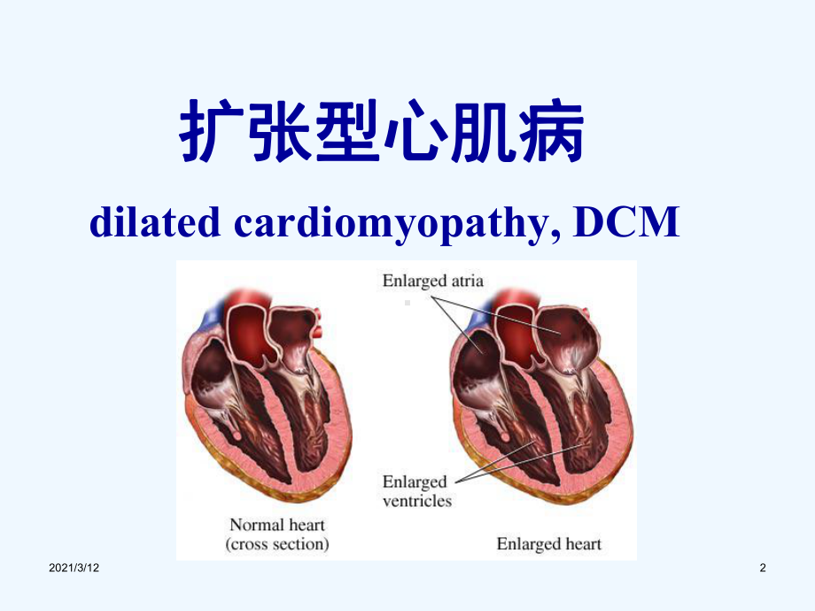 内科学-心肌疾病七年制课件.ppt_第2页