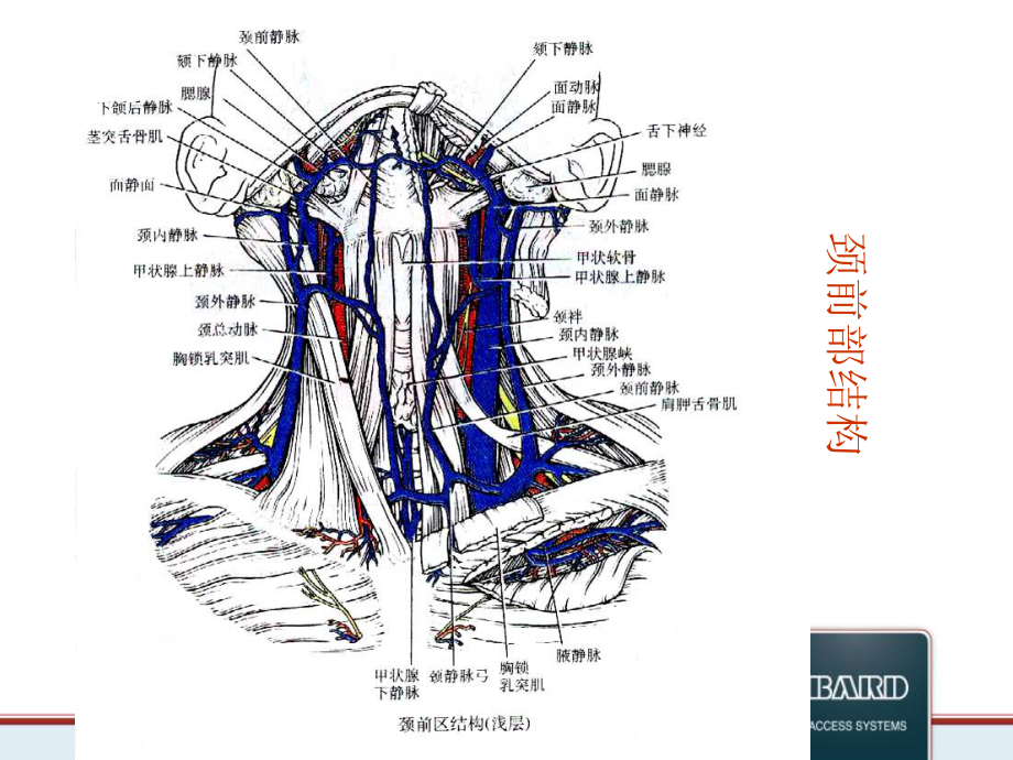 医学课件静脉输液港植入流程培训.ppt_第3页