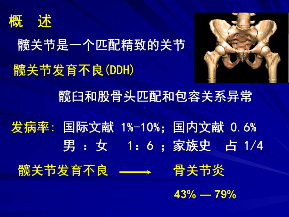 医学课件成人髋关节发育不良的手术选择.ppt_第1页