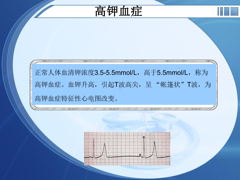 医学课件电解质紊乱心电图.ppt_第1页