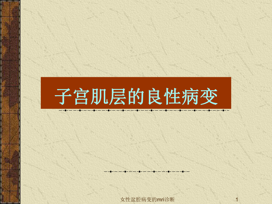 女性盆腔病变的mri诊断课件.ppt_第1页