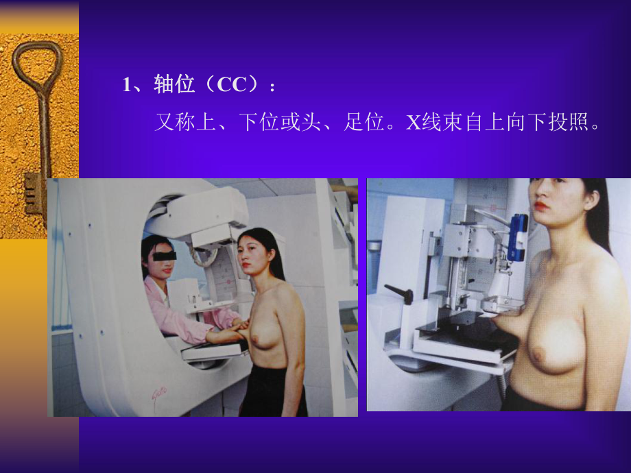 乳腺钼靶影像诊断学课件-2.ppt_第2页