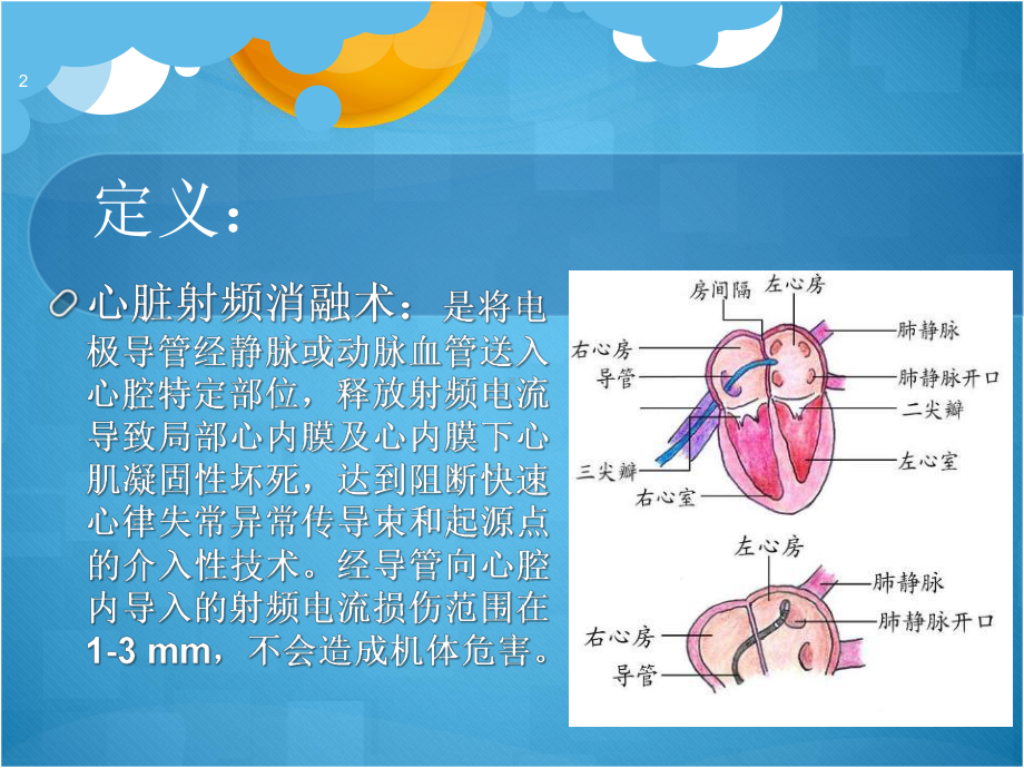 射频消融术术后护理课件.pptx_第2页