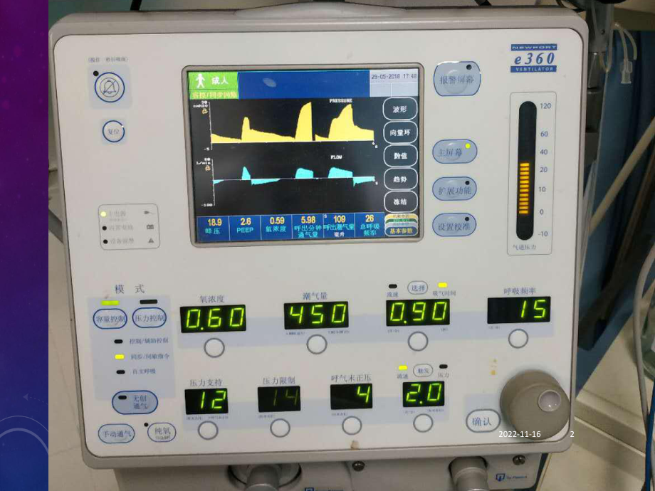 呼吸机常用模式参考课件.ppt_第2页