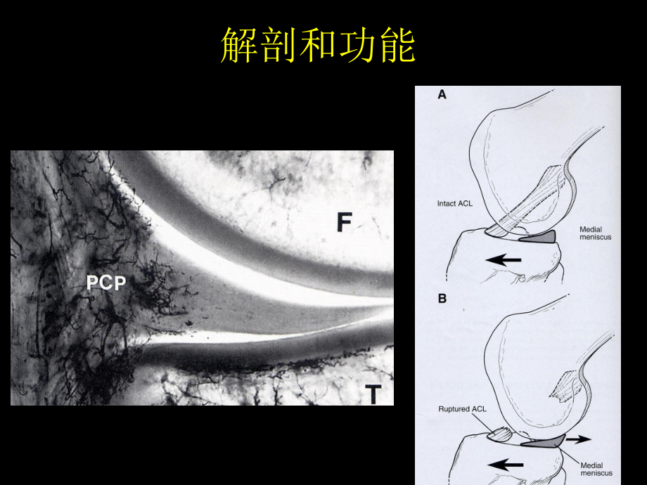 医学半月板损伤的关节镜技术中文课件.ppt_第3页