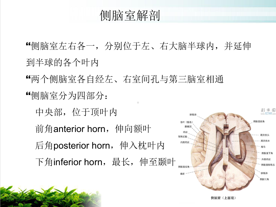 侧脑室肿瘤的诊断与鉴别课件.ppt_第3页