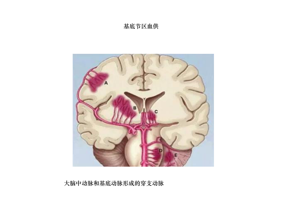 双侧基底节区对称性病变课件.ppt_第3页