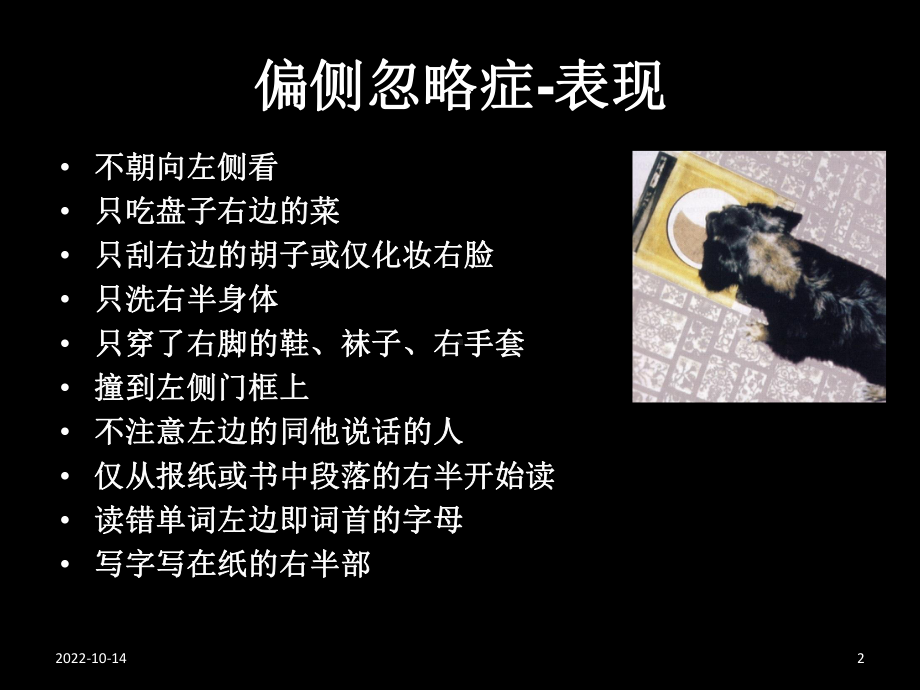 单侧忽略的概述评定和治疗培训课件.ppt_第2页