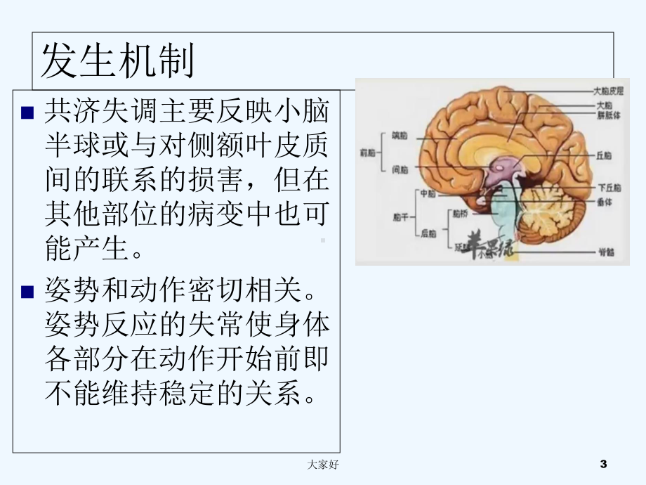 共济失调的诊断与治疗-课件.ppt_第3页