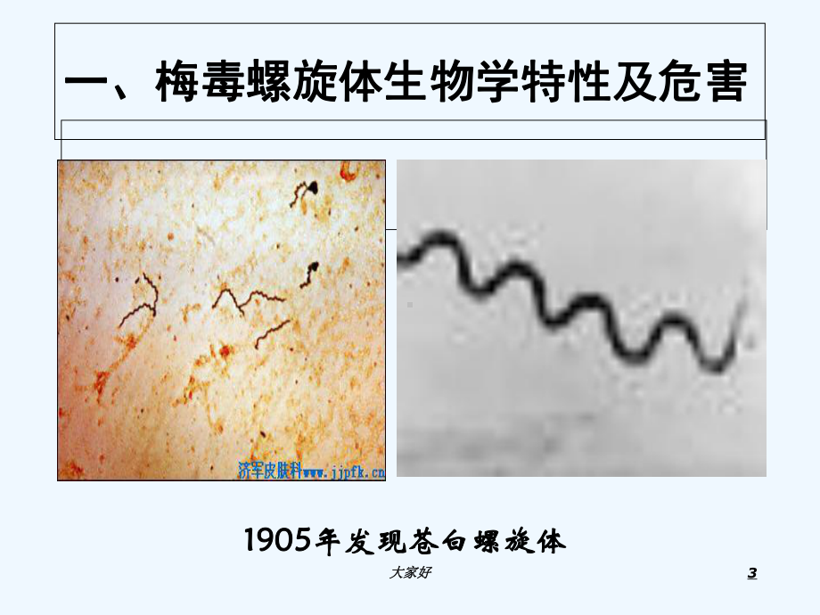 妊娠期梅毒的规范治疗-课件.ppt_第3页