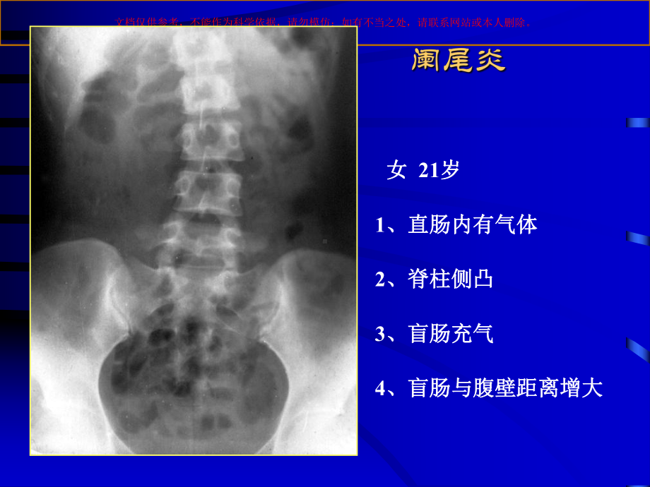 医学影像诊断急腹症影像诊断学培训课件.ppt_第2页