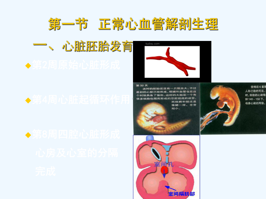 儿科学先天性心脏病课件.ppt_第3页