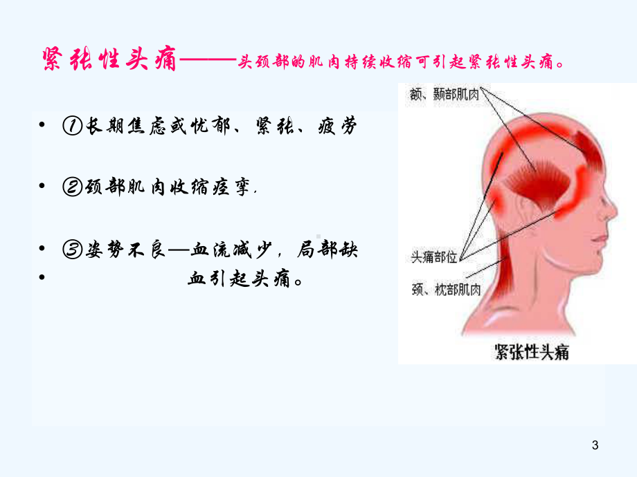 头痛中医诊疗技术课件.ppt_第3页