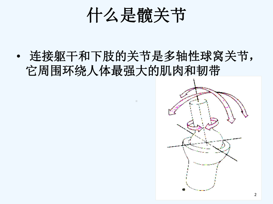 人工髋关节置换术的护理课件.ppt_第2页