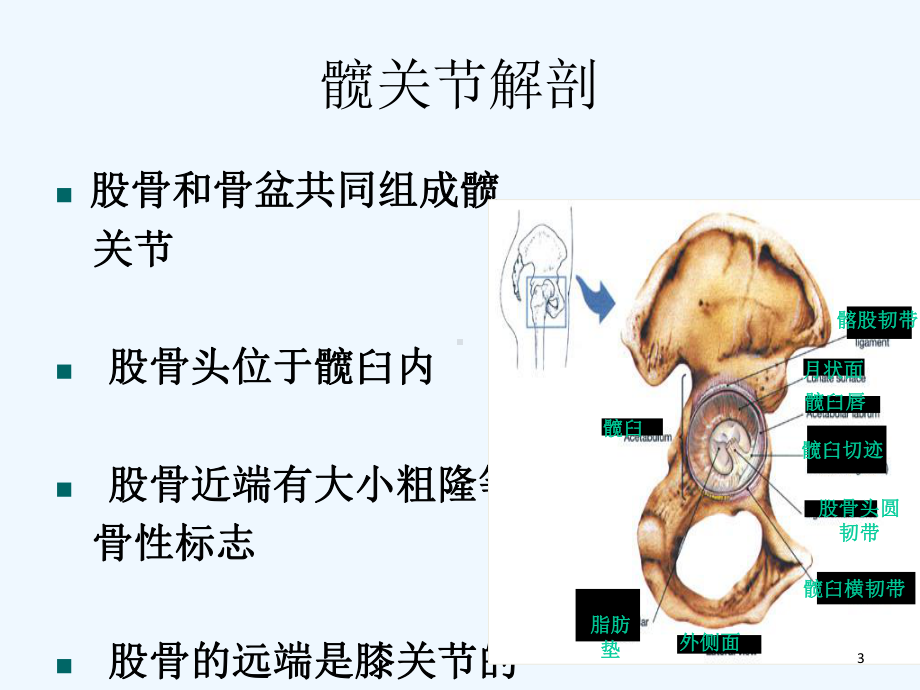 人工髋关节置换术的护理课件.ppt_第3页