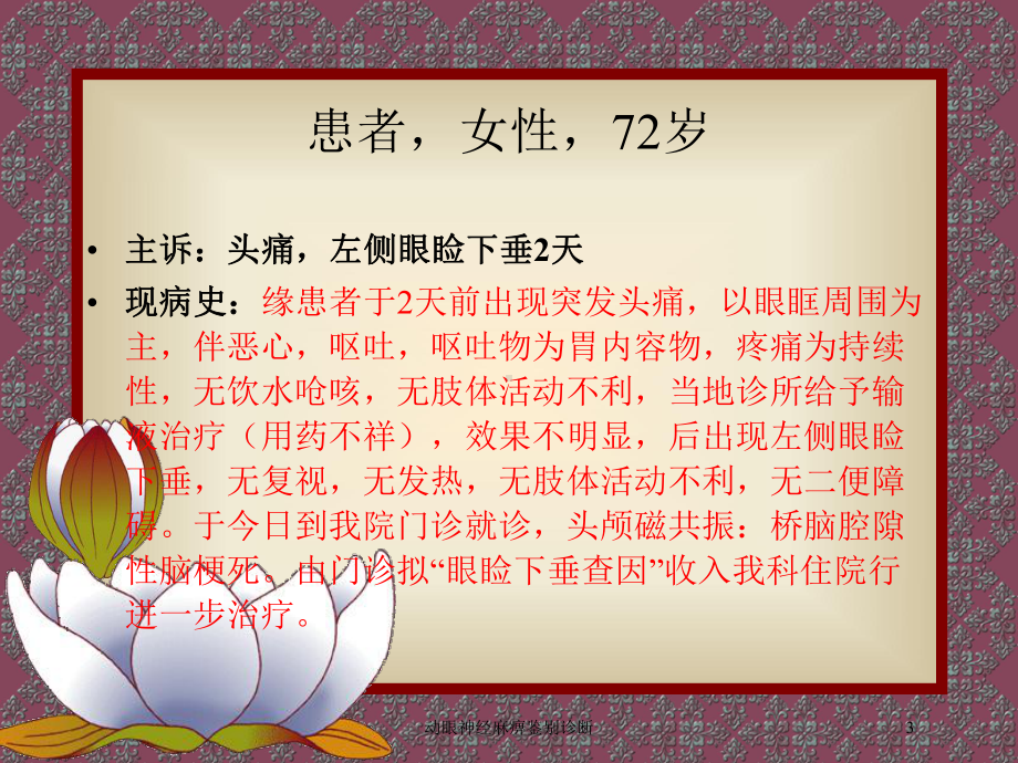 动眼神经麻痹鉴别诊断培训课件.ppt_第3页