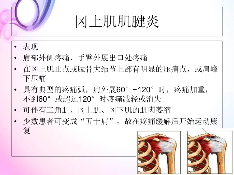 医学课件-肩关节课件.ppt_第3页