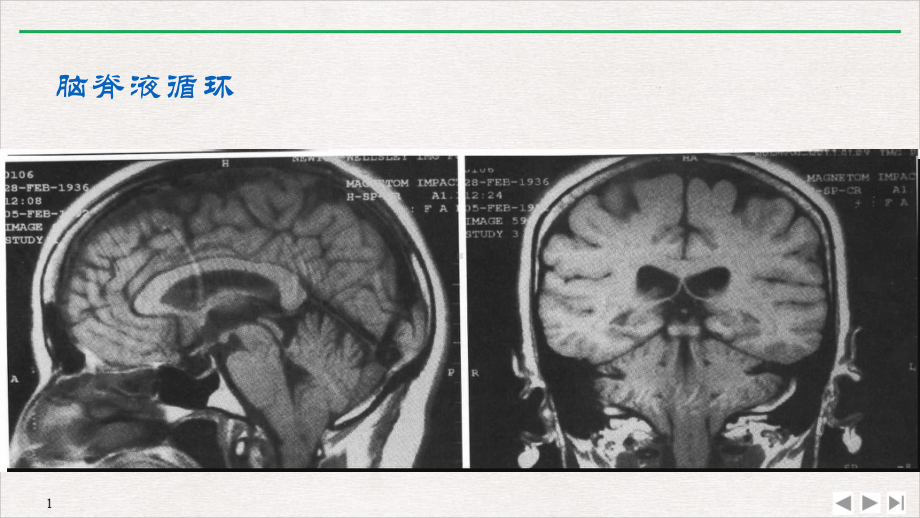 化脑病脑某医科大学完美课课件.pptx_第3页