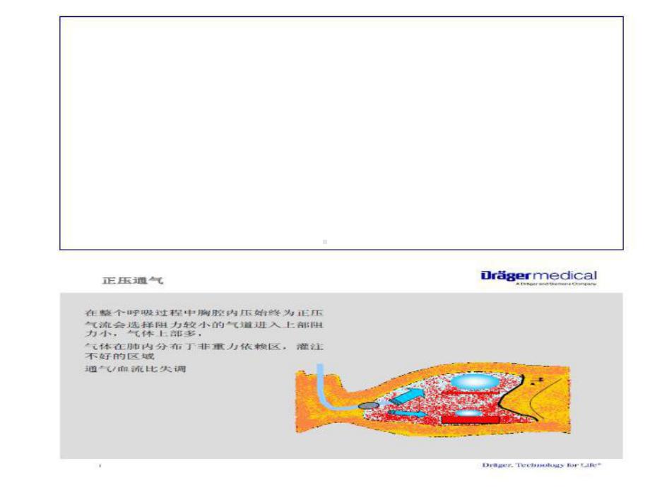 呼吸机历史和基本原理培训课件.ppt_第2页